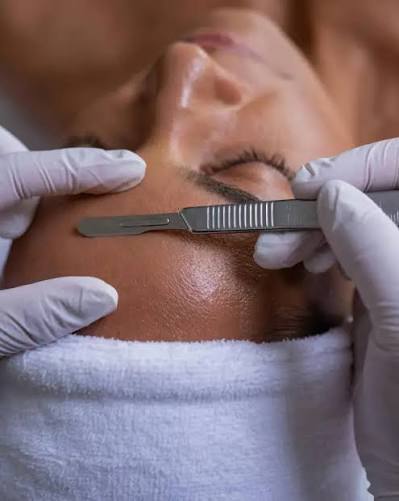 Dermaplaning